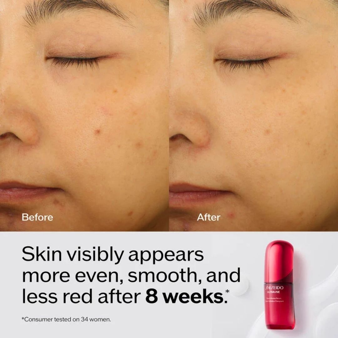 SHISEIDO ULTIMUNE POWER INFUSING CONCENTRATE (W) 75ML FACE SERUM